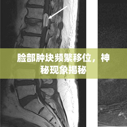 脸部肿块频繁移位，神秘现象揭秘