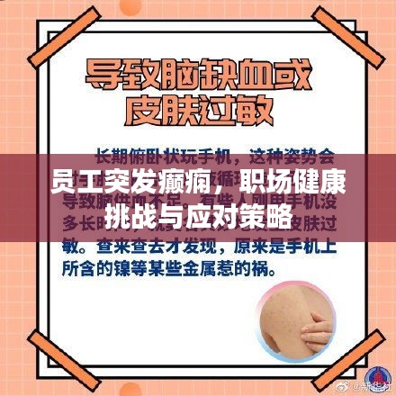 员工突发癫痫，职场健康挑战与应对策略