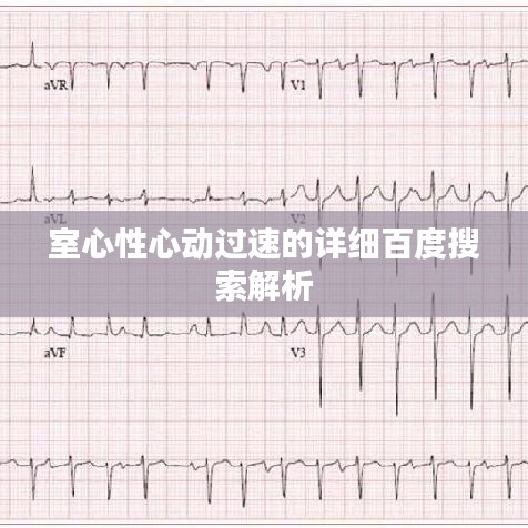室心性心动过速的详细百度搜索解析
