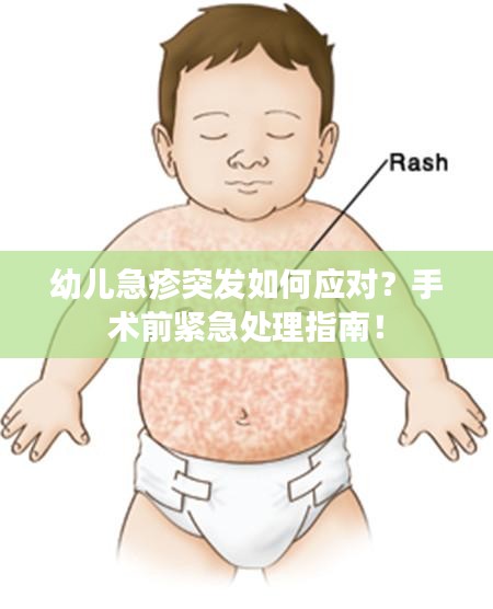 群雌粥粥