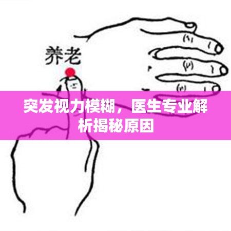 突发视力模糊，医生专业解析揭秘原因
